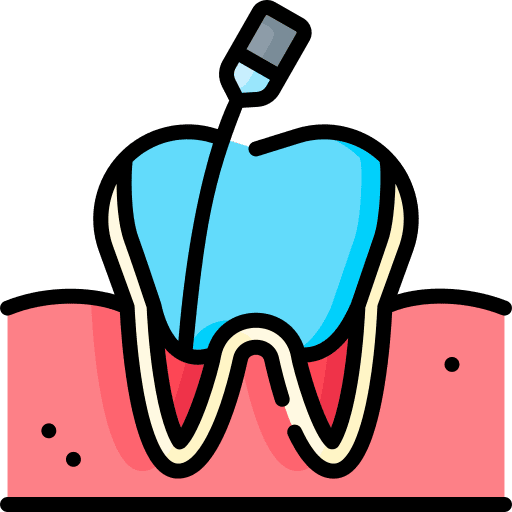 root canal treatment